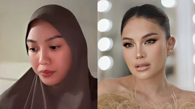 Nikita Mirzani Duga Ada Dalang di Balik Kaburnya Lolly dari Rumah Aman